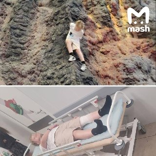 Школьник сломал позвоночник в московском "Острове мечты", перепутав декорацию с аттракционом. За это с парка взыскали почти 400 тысяч рублей.10-летний ребёнок в июне 2025 года залез на декоративный вулкан — тот стоял без ограждений и выглядел как обычная л