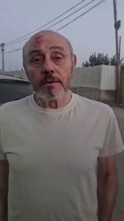 ד"ר מאזן אל-רנטיסי, רופא בן 71 ברמאללה המכונה בחיבה ברחבי הגדה המערבית "הרופא של העניים", נושא פצע פנים טרי…