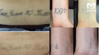 Дагестан стал центром России по удалению партаков. Забитые филасафскими цитатами, звёздочками, бабочками на поясницах и прочими ошибками молодости прилетают в республику, чтобы стереть прошлое.По данным Mash, причина в низкой стоимости услуги. Если в услов