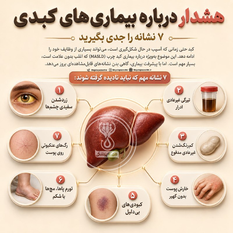 🗣 خبرهای داغ مجازی ✨️: هشدار درباره بیماریهای کبدیهفت نشانه را جدی بگیرید