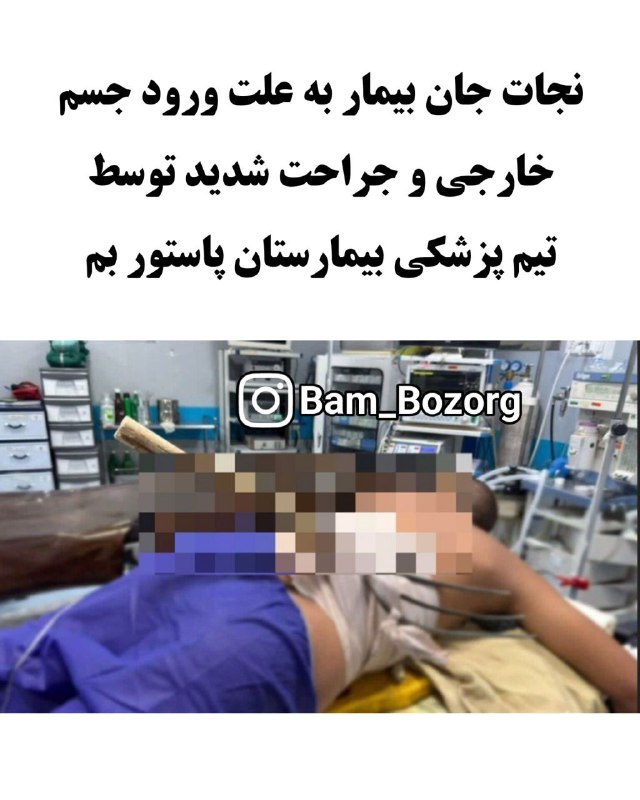 کانال بم: نجات جان بیمار به علت ورود جسم خارجی و جراحت شدید توسط تیم پزشکی بیمارستان پاستور بم🔸تیم پزشکی بیمارستان پاستور موفق شد 
