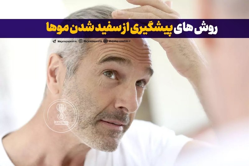 پزشک تلگرام: روش های پیشگیری از سفید شدن موها◽️آنتی اکسیدان های بیشتری بخورید؛ رژیم غذایی شما نقش مهمی در جلوگیری از سفید شدن موها دا