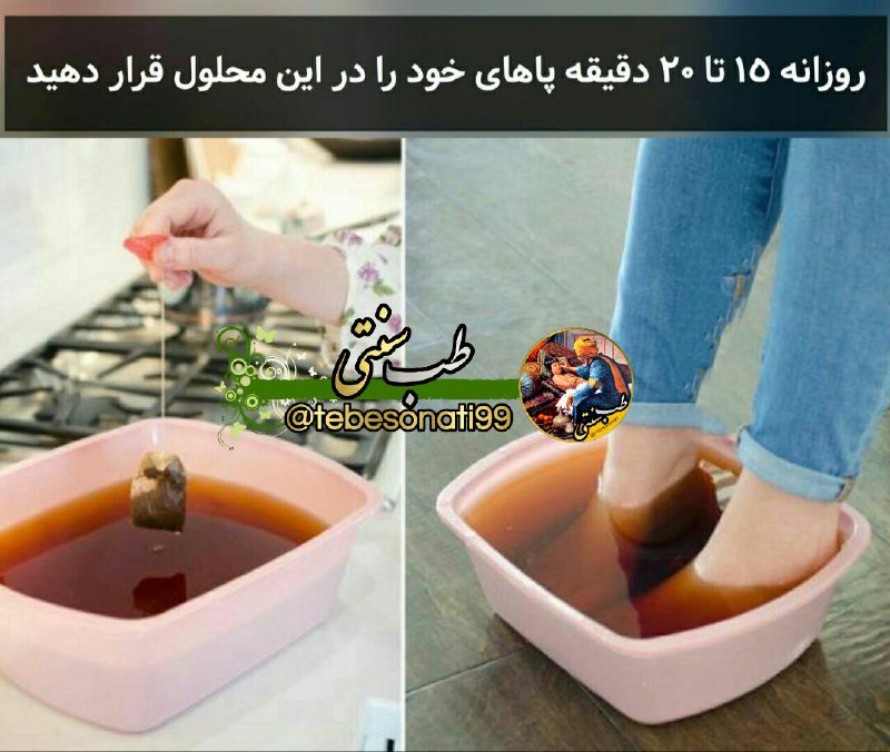 🍏طب سنتی🍏: هر دو روز 2 چای کیسه ای سیاه را در 3 فنجان آب بجوشانید و بگذارید خنک شود یا میتوانید درون آن یخ هم بی اندازید و 20دقیقه