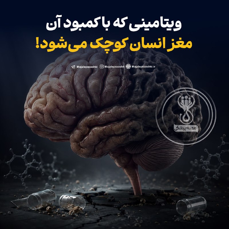 🗣 خبرهای داغ مجازی ✨️: ویتامینی که با کمبود آن مغز انسان کوچک می‌شود!ویتامین B12 فقط برای خو..نسازی نیست! کمبود شدید و طولانی‌مدت B12 می‌تونه ر