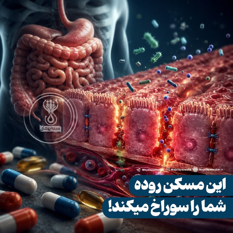 مجله پزشکی: این مسکن روده شما را سوراخ میکند!◽️مصرف مکرر مسکن‌هایی مثل ژلوفن و نوافن می‌تواند به سد دفاعی روده آسیب بزند و نفوذپذیری