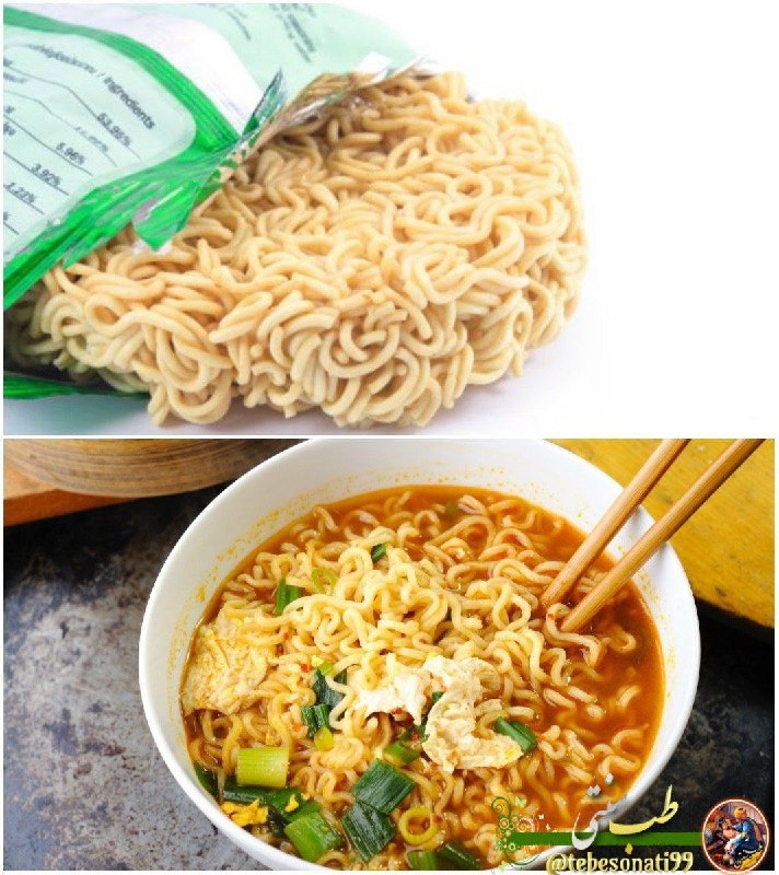 🍏طب سنتی🍏: نودل نخورید!🍜◽️ نودل حاوی مواد نگه‌دارنده مضر است به راحتی هضم نمیشود و ابتلا به بیماری‌های قلبی را افزایش میدهد و سرشار