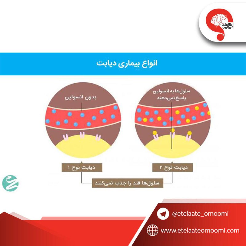 اطلاعات عمومی: دیابت از اون بیماریهاییه که خیلیها اصلا بهش فکر نمیکنند ولی وقتی مبتلا میشن تازه میفهمن چقدر زندگی قبل از دیابت داش