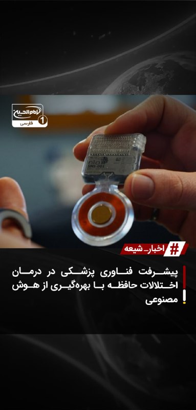 SHIAWAVES اخبار شیعه: پیشرفت فناوری پزشکی در درمان اختلالات حافظه با بهرهگیری از هوش مصنوعیپژوهشگران با ساخت یک تراشه و سیستم کاشتنی مغزی مبت