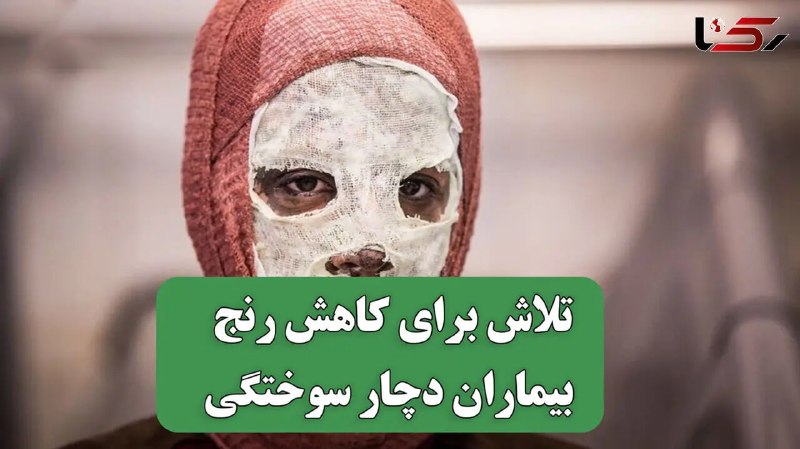 آژانس خبری رکنا | Rokna NEWS Agency: 🔶فراتر از یک سوختگی؛ روایت انسان هایی که برای کاهش رنج دیگران می جنگند🔸سالانه صدها هزار مورد سوختگی رخ می‌دهد و بخشی از 