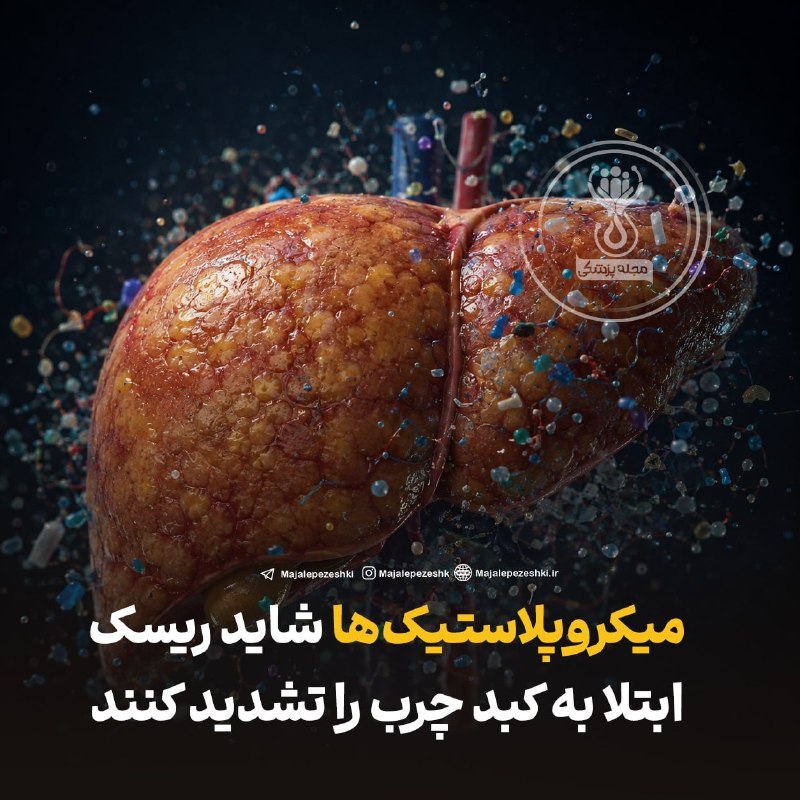 مجله پزشکی: میکروپلاستیکها شاید ریسک ابتلا به کبد چرب را تشدید کنند!◽️محققان میگویند پلیاتیلن (پرمصرفترین نوع پلاستیک در بستهبن