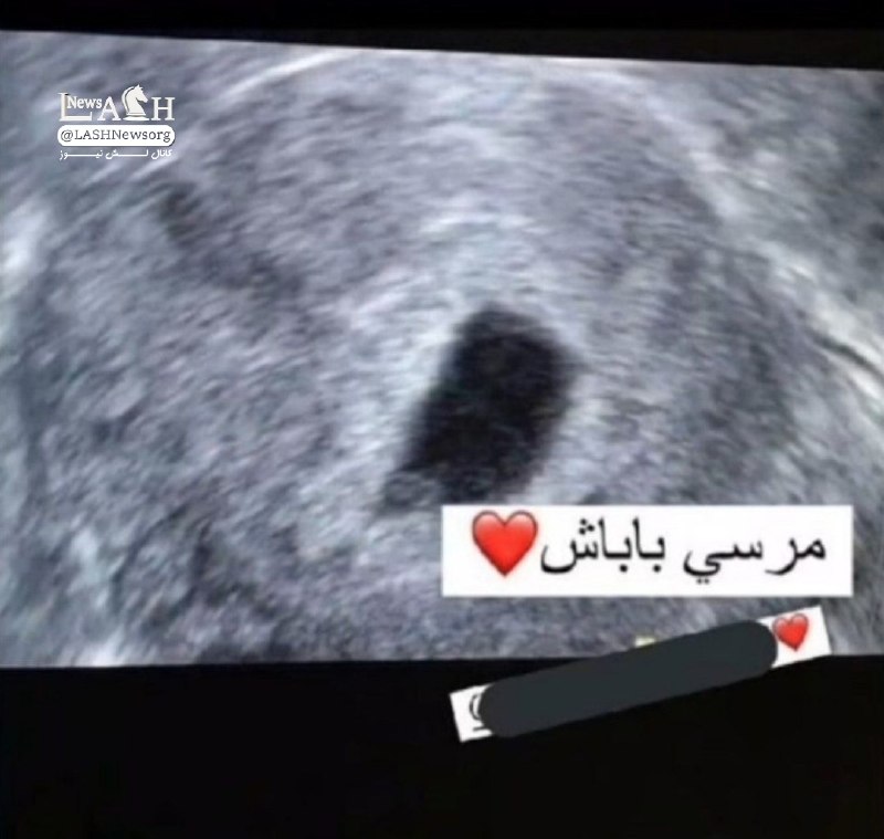 LASHNews | لش نیوز: استوری فامیلمون که بخاطر باردار شدنش از شوهرش تشکر کرده بود =))))))♻️Ctrl+R @LASHNewsorg ♟