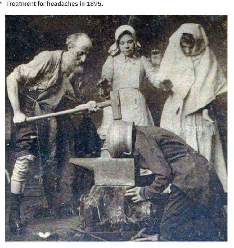 عجیب ترین ها: روش درمان سردرد در ۱۸۹۵!فک کن سرت داره میترکه بعد کلهت رو بکنی تو دیگ یکی با پتک هم بزنه روش!@irWonders