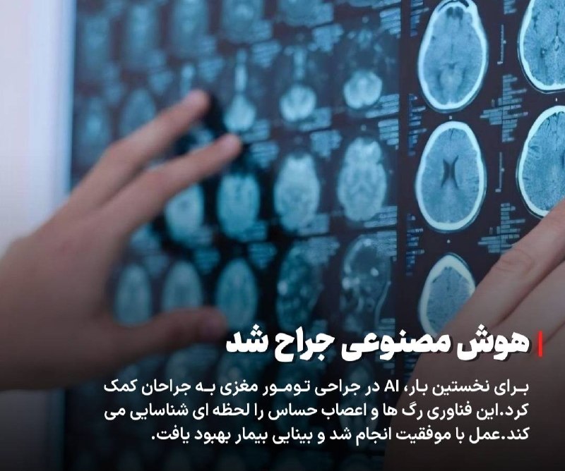 سایت خبری پُرسون: 🔴هوش مصنوعی جراح شد🔹برای نخستینبار، AI در جراحی تومور مغزی به جراحان کمک کرد.این فناوری رگها و اعصاب حساس را لحظهای ش