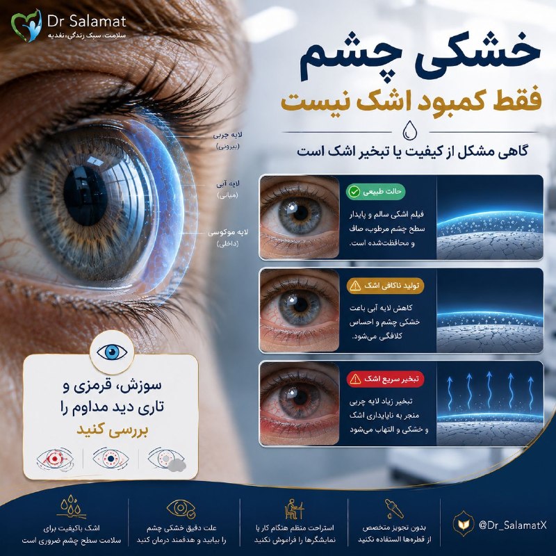 🍎 رسانه دکتر سلامت 🍏: 👀 خشکی چشم همیشه یعنی «کمبود اشک» نیست👁 خشکی چشم فقط زمانی اتفاق نمی‌افتد که اشک کمی تولید شود. گاهی اشک به‌سرعت تبخیر م