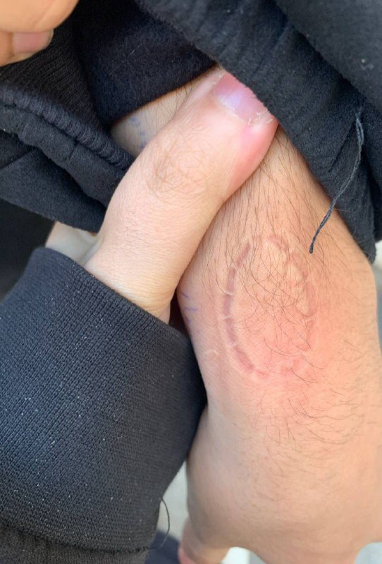 TORTURE: رسانه پست