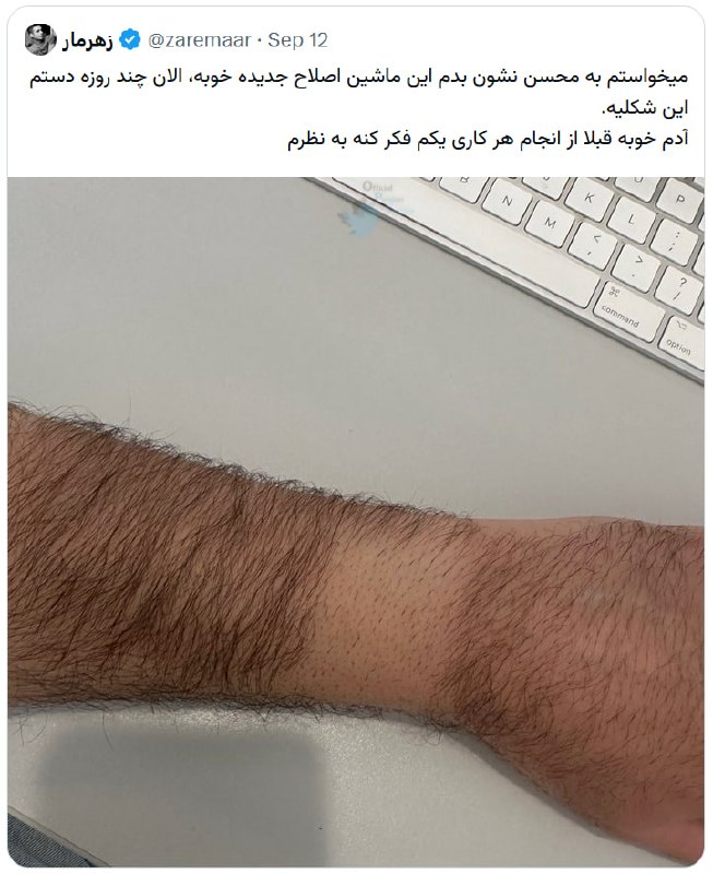 توییتر فارسی: حاضره چند روز اینطوری بگرده ولی بقیه پشماشو نزنه، عقل مرد》مهوس《@OfficialPersiaTwiter