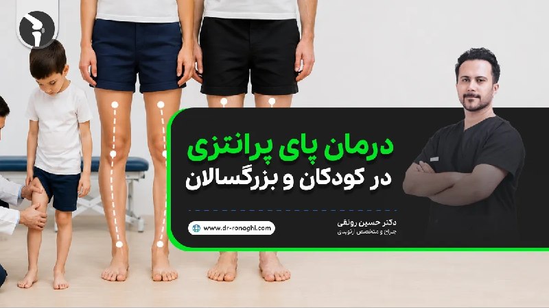 دکتر حسین رونقی متخصص جراحی ارتوپدی: درمان پای پرانتزی در کودکان و بزرگسالان+بهترین روش اصلاح پای پرانتزیشاید برایتان جالب باشد بدانید که بیشتر نوزادان با پا