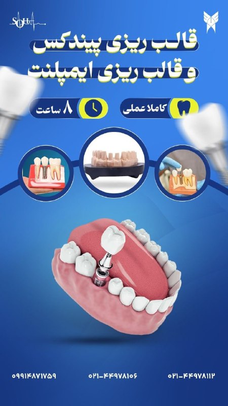 Soha: 🎓 دوره تخصصی قالبریزی پیندکس و قالب ریزی ایمپلنت💡 ویژگیهای دوره:🔹 آموزش کامل قالبریزی پیندکس و قابل ریزی ایمپلنت بهص