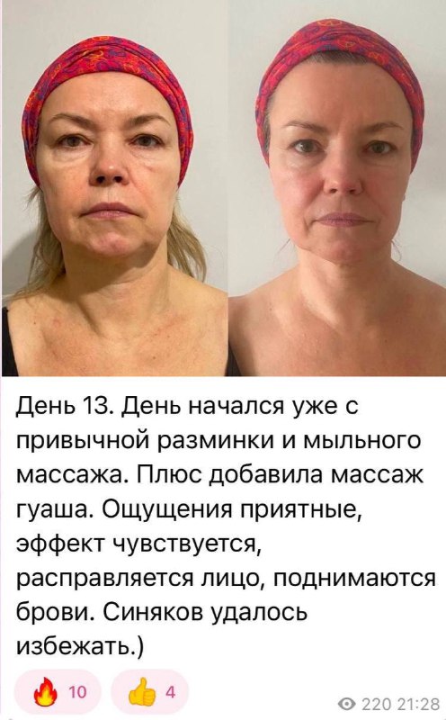 Image from a post by Омоложение лица: техники самомассажа и фейсфитнес.