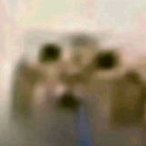 ЩП уретры