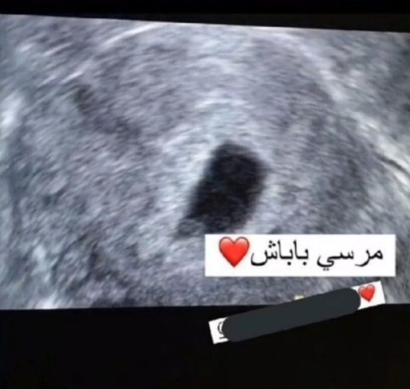 کانال درهم برهم 💯: استوری فامیلمون که بخاطر باردار شدنش از شوهرش تشکر کرده بود😄🆑 @BarhamTel 💯👈