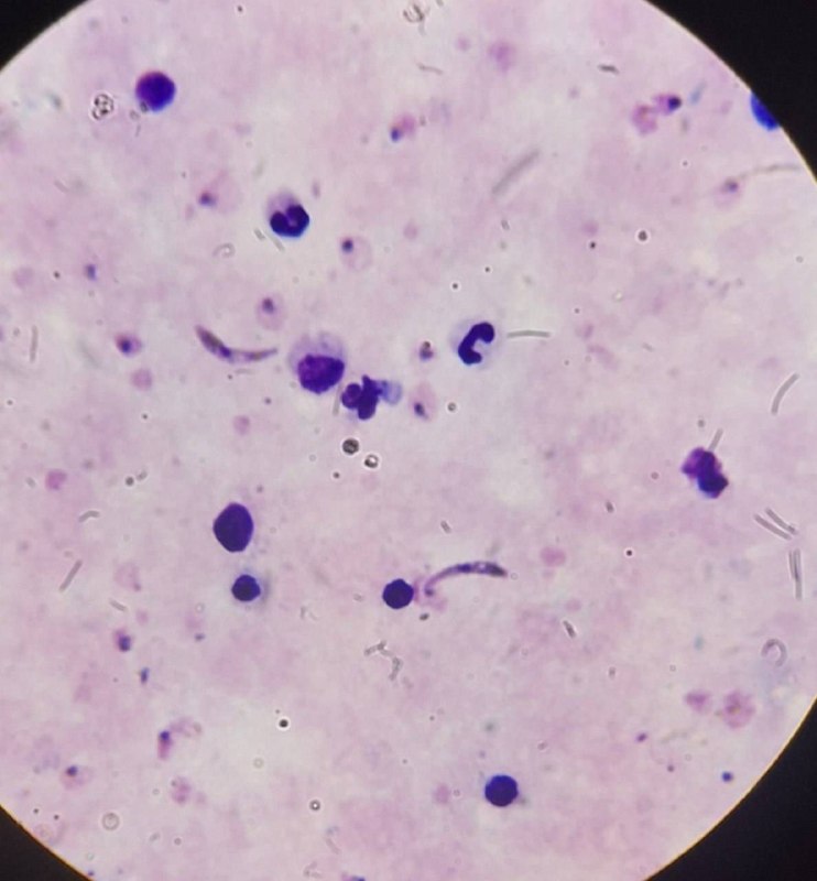 Hemato of ARTA-Lab: رسانه پست