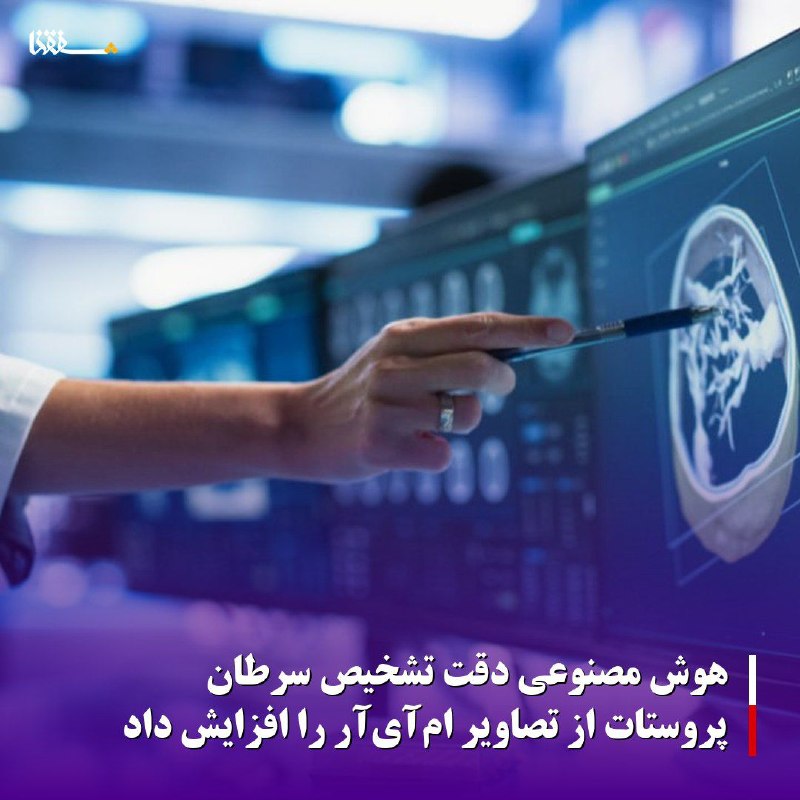 خبرگزاری بین المللی شفقنا: هوش مصنوعی دقت تشخیص سرطان پروستات از تصاویر ام‌آی‌آر را افزایش دادیک چارچوب دو مرحله‌ای مبتنی بر هوش مصنوعی می‌تواند با