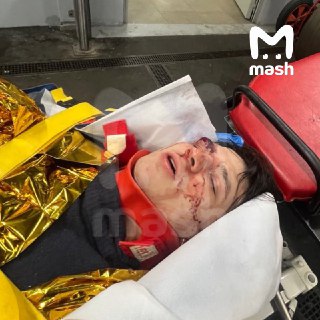 Рэпер Васио попал в реанимацию в Париже после падения с трёх этажей сквозь стеклянную крышу, сообщила его знакомая.Несчастный случай произошёл прошлой ночью — артист получил тяжёлые травмы и сейчас в критическом состоянии. Страховки во Франции у него нет, 