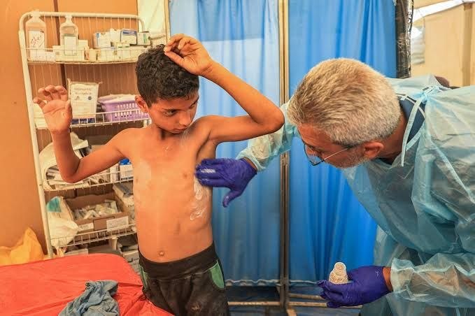 مرکز اطلاعرسانی فلسطین: 🔴مدیر امداد پزشکی غزه: خطر گسترش بیماریهای همهگیر و ویروسها جدی استمدیر امداد پزشکی در نوار غزه در گفتگو با شبکه الجز