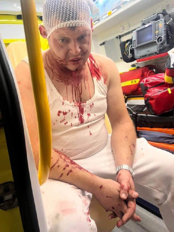 У Польщі стався черговий напад на українців: травмовано трьох наших співгромадян