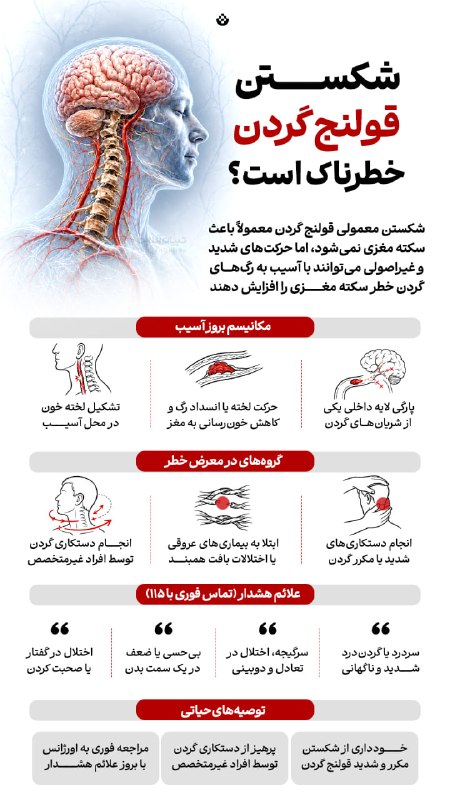 پارسبان: #سلامتیشکستن قولنج گردن خطرناک است؟▪️ شکستن معمولی قولنج گردن معمولاً باعث سکته مغزی نمیشود، اما حرکتهای شدید و غیراصو