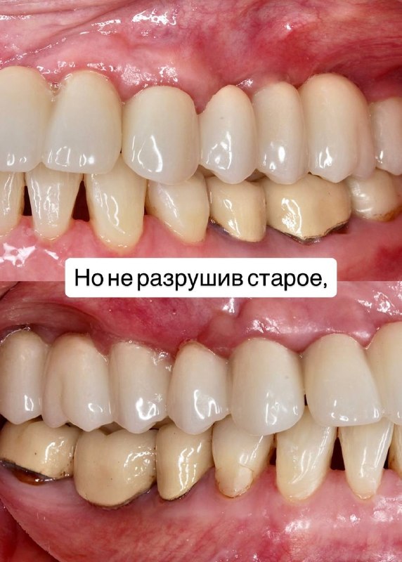 Image from a post by UC_STOM_DENTAL