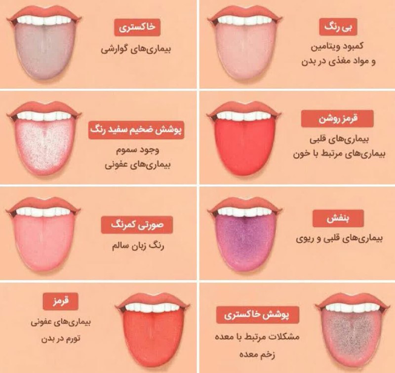 صادقیه ( محبّی ): رنگ زبـان با ما حرف های زیادی میزند و میتواند بیماری های ما را افشا کند...