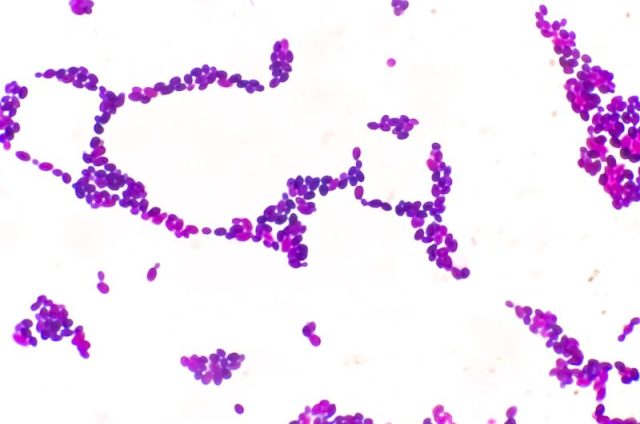 Drug-resistant fungus Candida auris reported in these 17 states