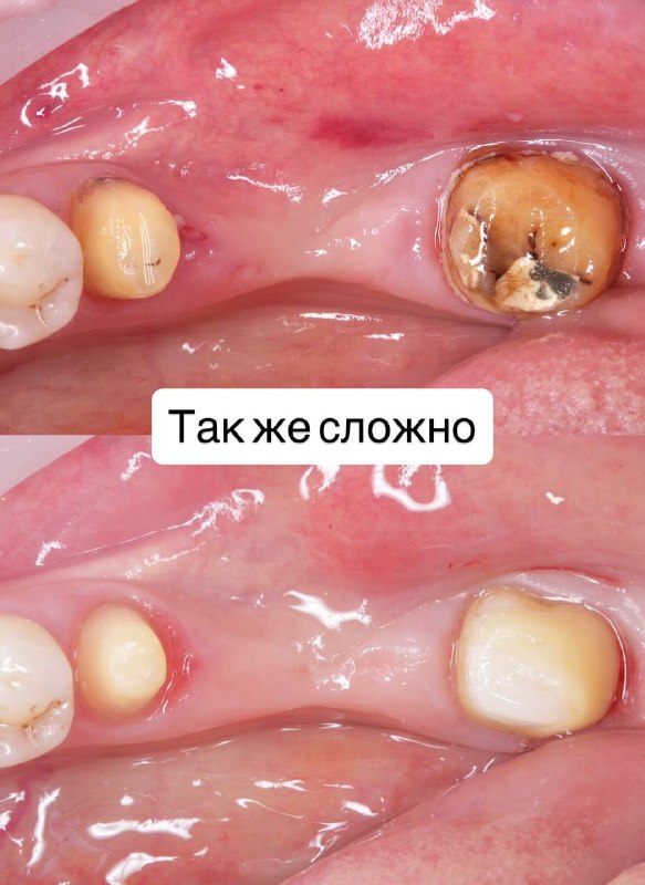 Image from a post by UC_STOM_DENTAL