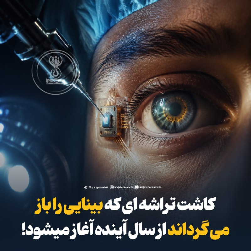 مجله پزشکی: کاشت تراشه ای که بینایی را باز می گرداند از سال آینده آغاز میشود!◽️ایلان ماسک اعلام کرده نورالینک قصد دارد طی ۶ تا ۱۲ ما
