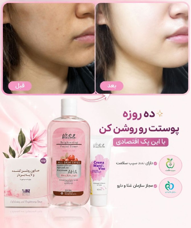 همدانیا: ✨ ده روزه پوستت رو روشن کن! ✨🌸 پک اقتصادی روشن شدن پوست:🧼 صابون روشن‌کننده و لایه‌بردار💧 تونر روشن‌کننده ویتابلا🥑 کرم آو