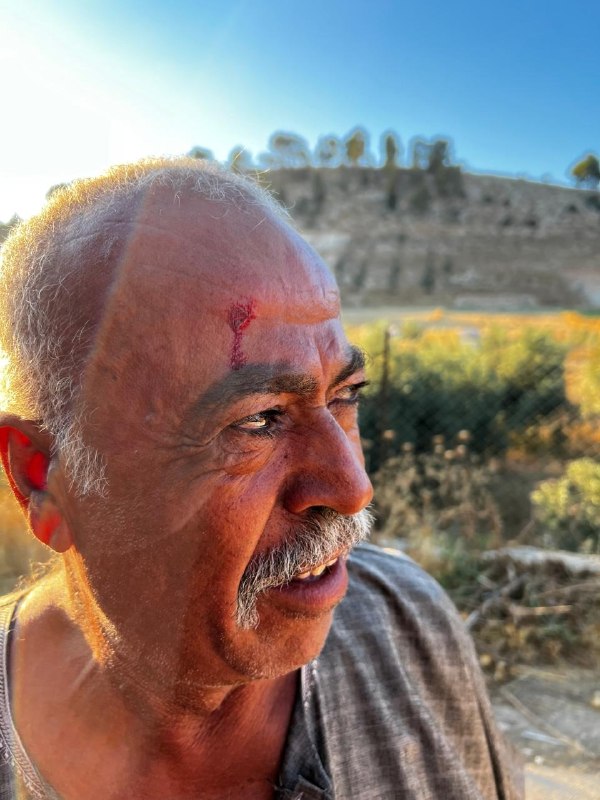 קשיש נפצע בתקיפת מתיישבים ליד אידנא ממערב לחברון