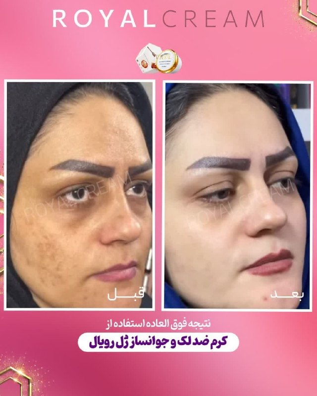 🌱🌱اندام جذاب🌱🌱: قبل و بعد جذاب🤩🤩09014265293@yassamminn