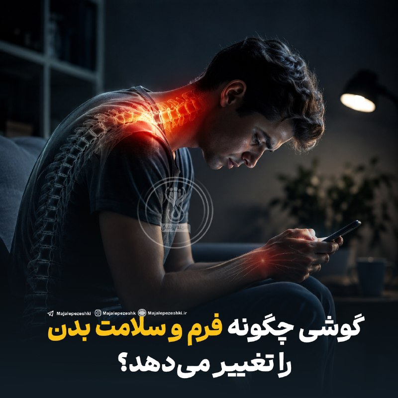 🌺میگون در گذر زمان🌺: _گوشی چگونه فرم و سلامت بدن را تغییر می‌دهد؟◽️استفاده طولانی از گوشی و خم نگه داشتن مداوم سر می‌تواند به‌مرور الگوی نشست