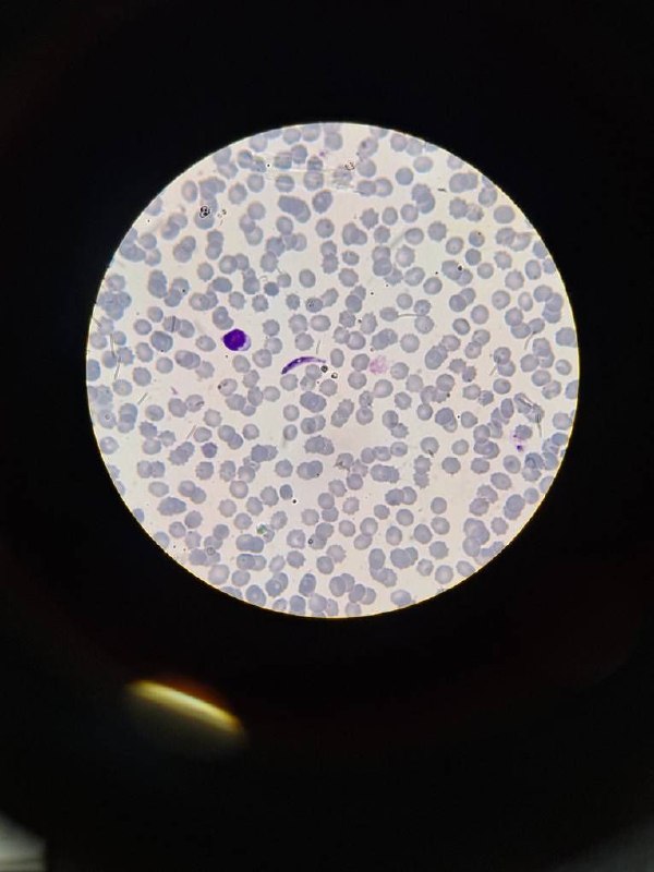 Hemato of ARTA-Lab: رسانه پست