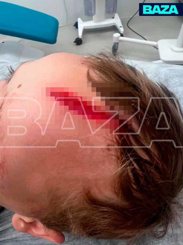 Акита-ину без поводка набросилась на 7-летнего внука Дарьи Донцовой в Подмосковье