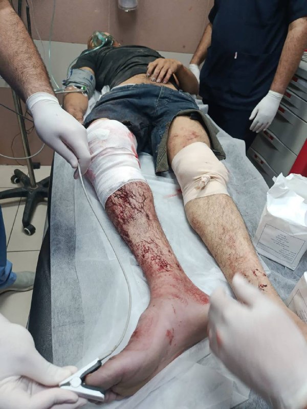 עדכון דחוף: צעיר מהעיירה רומנה, מערבית לג'נין, נפצע מכדורים של צבא הכיבוש סמוך לחומת ההפרדה בעיירה אל-ראם…