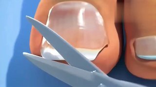 「医学科普：你应该知道的关于指甲的几个误区……」@knowledge1024