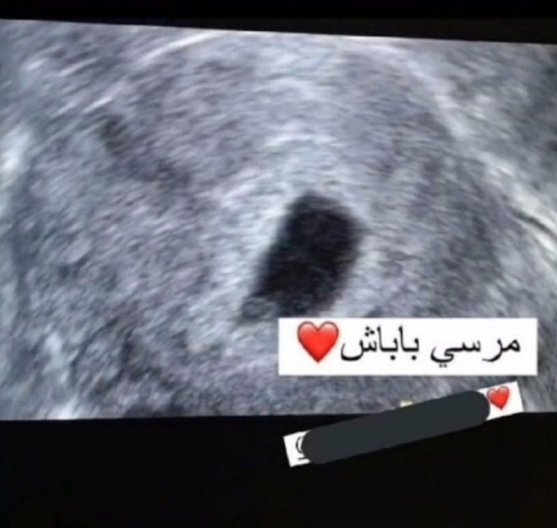 پاتوق: استوری فامیلمون که بخاطر باردار شدنش از شوهرش تشکر کرده بود =))))))@patogh