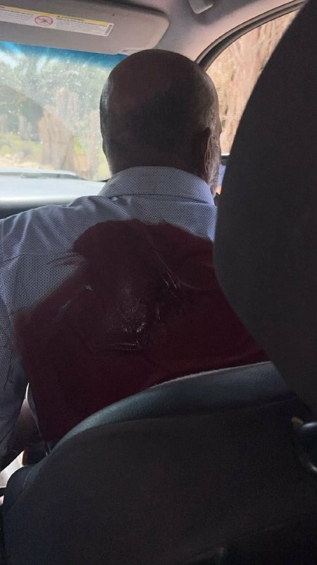 מקורות מקומיים: מתנחלים יירטו אזרח פלסטיני שרכבו התקלקל בכביש אל-מרג'ת ביריחו. הם דקרו אותו בגבו והאזרח הצל…