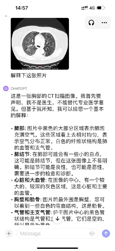 9个GPT-4V 用例：1、菜单翻译（其实甚至没文字只有菜品图都没问题）2、随身导游，逛博物馆时会很好用3、厨房助力，拍冰箱或者菜市场的照片让ChatGPT推荐做什么4、家装设计师，拍张家里的照片就可以获取装修建议5、穿搭建议，拍个全身照可以获得穿搭建议6、看手相7、X光片解读8、CT扫描解读9、安检机的X光线图像也能解读，用来辅助人工理解应该也有机会很快落地9个GPT-4V 用例：1、菜单翻译（其实甚至没文字只有菜品图都没问题）2、随身导游，逛博物馆时会很好用3、厨房助力，拍冰箱或者菜市场的照片让ChatGPT推荐做什么4、家装设计师，拍张家里的照片就可以获取装修建议5、穿搭建议，拍个全身照可以获得穿搭建议6、看手相7、X光片解读8、CT扫描解读9、安检机的X光线图像也能解读，用来辅助人工理解应该也有机会很快落地
