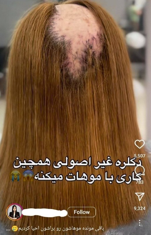T E X T D R E G: فوبیای جدید آوردم براتون🌸