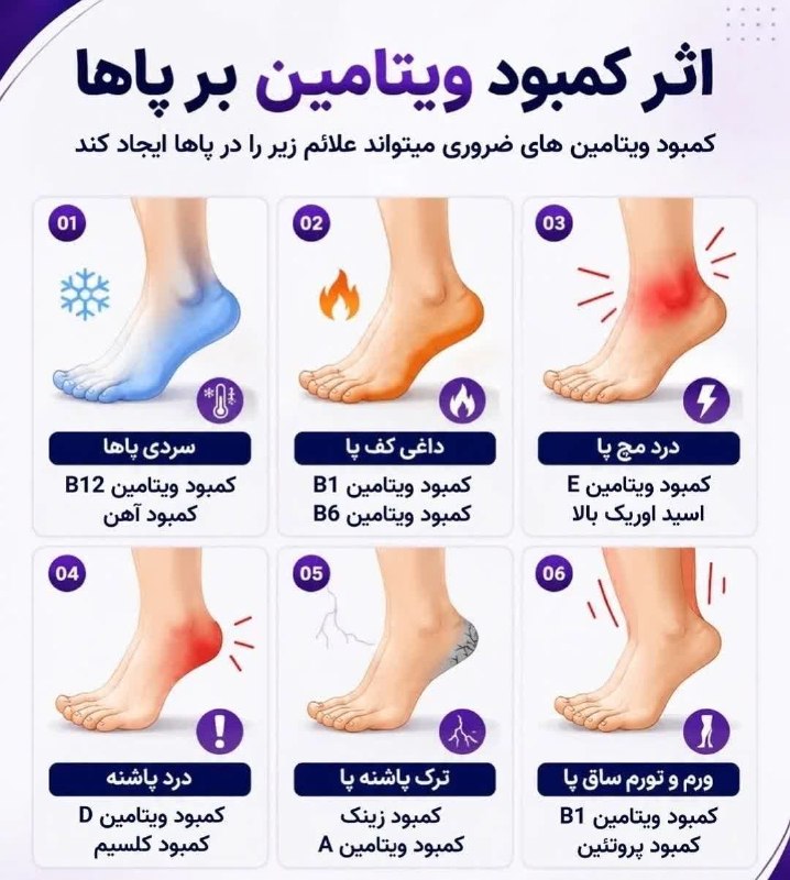🍃﷽🍃 سنگ صبور🍃﷽🍃: 🔴کمبود ویتامین های ضروری میتواند علائم زیر را در پاها ایجاد کند#سالم_باشیم🍂🌹 @sangesabur 🌹🍂