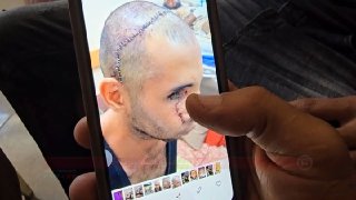 عائلة دبور بغزة تواجه الجوع والجراح